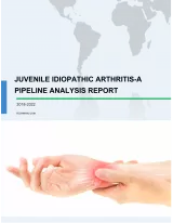 Juvenile Idiopathic Arthritis - A Pipeline Analysis Report